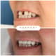 Slider image (9) Adaport Dental Clinic